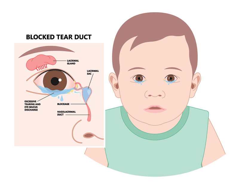 Sharing Printable Eye Tear Duct Printable